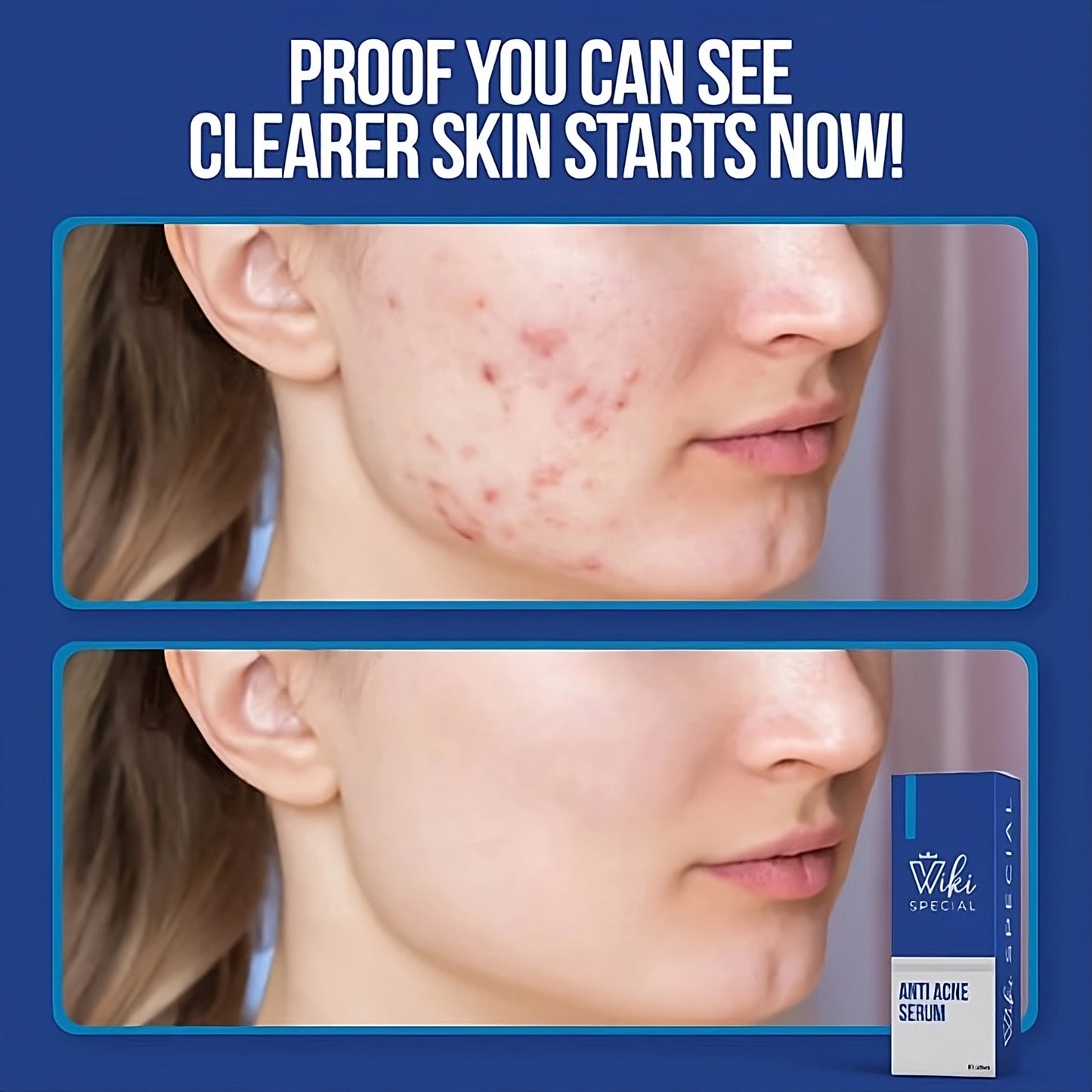 Wiki Special Serum - Miraaj